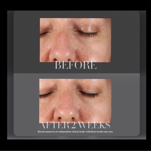 Kate Somerville Resurfacing Overnight Peel Brand New In Box - Picture 7 of 10